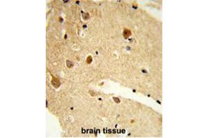 Formalin-fixed and paraffin-embedded human brain tissue reacted with CNDP1 Antibody (C-term), which was peroxidase-conjugated to the secondary antibody, followed by DAB staining. (CNDP1 antibody  (C-Term))