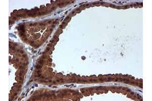 Immunohistochemical staining of paraffin-embedded Human breast tissue using anti-HARS2 mouse monoclonal antibody. (HARS2 antibody)