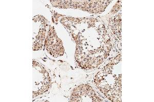 Immunohistochemical analysis of paraffin-embedded human testis tissue using B performed on the Leica® BOND RXm. (STRA8 antibody  (C-Term))