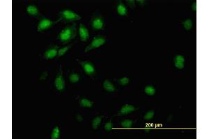 Immunofluorescence of monoclonal antibody to ID3 on HeLa cell. (ID3 antibody  (AA 1-83))
