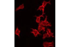 ABIN6272367 staining COLO205 by IF/ICC. (NRIP3 antibody  (C-Term))