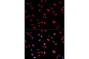 Immunofluorescence (IF) image for anti-Jun Proto-Oncogene (JUN) (pThr239) antibody (ABIN1870293) (C-JUN antibody  (pThr239))