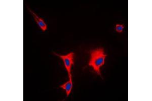 Immunofluorescent analysis of HSP90 alpha staining in HeLa cells.