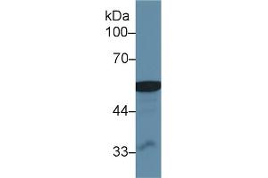 Western Blot; Sample: Human Liver lysate; Primary Ab: 1µg/ml Rabbit Anti-Human ALDM Antibody Second Ab: 0. (ALDH2 antibody  (AA 59-150))