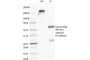 SDS-PAGE Analysis Purified AMACR / p504S Mouse Monoclonal Antibody (AMACR/1723). (AMACR antibody)