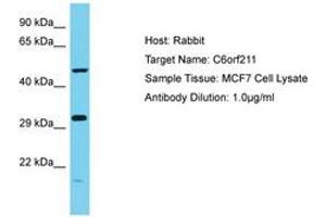 Image no. 1 for anti-ARMT1 (AA 102-151) antibody (ABIN6750670) (ARMT1 (AA 102-151) antibody)