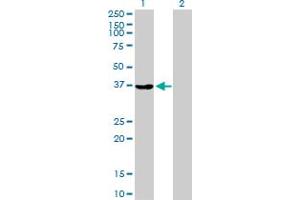 Western Blot analysis of AKR1A1 expression in transfected 293T cell line by AKR1A1 MaxPab polyclonal antibody. (AKR1A1 antibody  (AA 1-325))