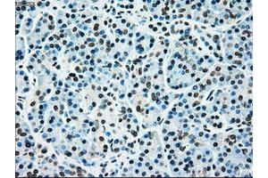 Image no. 8 for anti-Mitogen-Activated Protein Kinase Kinase 4 (MAP2K4) antibody (ABIN1499481)