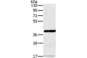 Western blot analysis of Mouse liver tissue, using OTC Polyclonal Antibody at dilution of 1:650