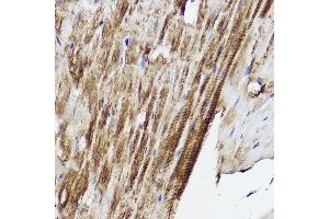 Immunohistochemistry of paraffin-embedded mouse heart using PLOD3 Rabbit pAb (ABIN6130652, ABIN6145791, ABIN6145792 and ABIN6214834) at dilution of 1:50 (40x lens). (PLOD3 antibody  (AA 25-280))