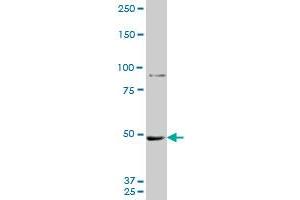 MTA1 monoclonal antibody (M10A), clone 1C3. (MTA1 antibody  (AA 601-700))