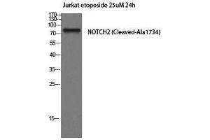 Western Blotting (WB) image for anti-Notch 2 (NOTCH2) (Cleaved-Ala1734), (Internal Region) antibody (ABIN6281639) (NOTCH2 antibody  (Cleaved-Ala1734, Internal Region))