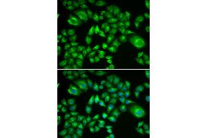 Immunofluorescence analysis of A549 cells using H6PD antibody (ABIN5973840). (Glucose-6-Phosphate Dehydrogenase antibody)