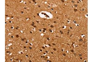 The image on the left is immunohistochemistry of paraffin-embedded Human brain tissue using ABIN7190032(CABLES2 Antibody) at dilution 1/25, on the right is treated with synthetic peptide. (CABLES2 antibody)