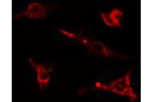 ABIN6274588 staining Hela cells by IF/ICC. (beta Arrestin 1 antibody  (C-Term))