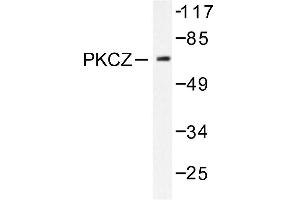 Image no. 1 for anti-Protein Kinase C, zeta (PRKCZ) antibody (ABIN271785)
