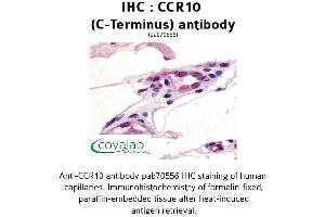Image no. 1 for anti-Chemokine (C-C Motif) Receptor 10 (CCR10) (C-Term) antibody (ABIN1732758) (CCR10 antibody  (C-Term))