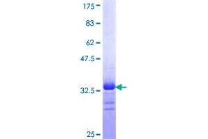 SCN9A Protein (AA 269-339) (GST tag)