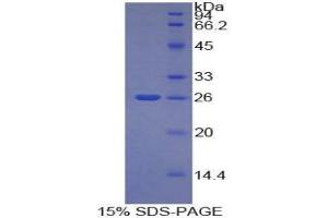 SDS-PAGE (SDS) image for Tumor Necrosis Factor (Ligand) Superfamily, Member 14 (TNFSF14) (AA 51-239) protein (His tag) (ABIN1081078)