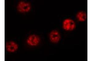 ABIN6272436 staining HT29 by IF/ICC. (ELP2 antibody  (Internal Region))