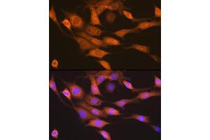 Immunofluorescence (IF) image for anti-Ribosomal Protein S6 Kinase, 70kDa, Polypeptide 2 (RPS6KB2) antibody (ABIN7270034)