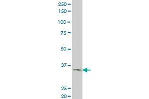 LDB3 monoclonal antibody (M06), clone 3C8 Western Blot analysis of LDB3 expression in A-431 . (LIM Domain Binding 3 Protein antibody  (AA 1-283))