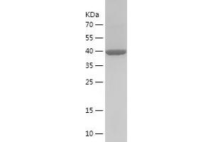 Western Blotting (WB) image for Calreticulin (CALR) (AA 25-199) protein (His-IF2DI Tag) (ABIN7283995) (Calreticulin Protein (CALR) (AA 25-199) (His-IF2DI Tag))