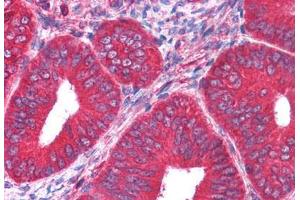 Human Uterus (formalin-fixed, paraffin-embedded) stained with PKM2 antibody ABIN293067 at 5 ug/ml followed by biotinylated anti-goat IgG secondary antibody ABIN481715, alkaline phosphatase-streptavidin and chromogen. (Pyruvate Kinase, Muscle (PKM) antibody)