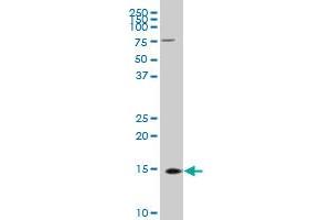 TTC11 polyclonal antibody (A01), Lot # 051206JC01 Western Blot analysis of FIS1 expression in MES-SA/Dx5 . (Fission 1 antibody  (AA 1-152))