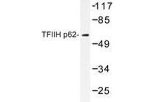Western blot analysis of TFIIH p62 antibody in extracts from Jurkat cells. (GTF2H1 antibody)