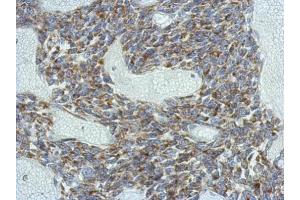 IHC-P Image Immunohistochemical analysis of paraffin-embedded BT483 xenograft, using KCNG4, antibody at 1:500 dilution. (KCNG4 antibody  (Center))