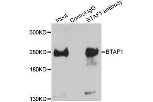Immunoprecipitation analysis of 150ug extracts of HeLa cells using 3ug BTAF1 antibody. (BTAF1 antibody  (AA 1600-1849))