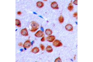 Immunohistochemical analysis of OLFML2B staining in human brain formalin fixed paraffin embedded tissue section. (OLFML2B antibody  (Center))