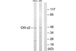 Western blot analysis of extracts from HeLa/293 cells, using CKI-gamma2 Antibody. (Casein Kinase 1 gamma 2 antibody  (AA 10-59))