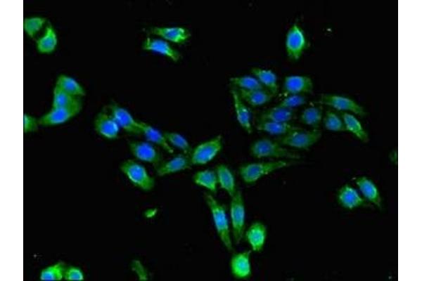 CDKAL1 antibody  (AA 1-97)