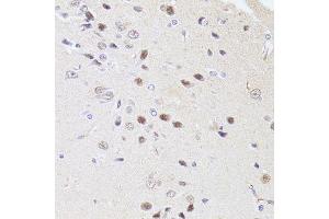 Immunohistochemistry of paraffin-embedded rat brain using DMAP1 antibody. (DMAP1 antibody  (AA 1-305))