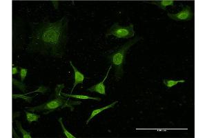 Immunofluorescence of monoclonal antibody to C4B on HeLa cell. (C4B antibody  (AA 1347-1446))