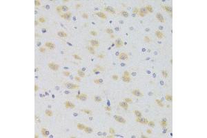 Immunohistochemistry of paraffin-embedded rat brain using SCO2 Antibody.