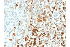 Immunohistochemistry (IHC) image for anti-Vimentin (VIM) antibody (ABIN6940885)
