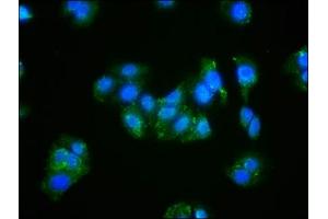 Immunofluorescence staining of HepG2 cells with ABIN7143136 at 1:166, counter-stained with DAPI.
