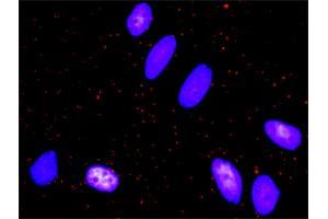 Proximity Ligation Analysis of protein-protein interactions between EGFR and FOS. (c-FOS antibody  (AA 1-380))