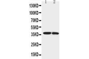 Anti-IGFBP1 antibody, Western blotting Lane 1: SMMC Cell Lysate Lane 2: MCF-7 Cell Lysate
