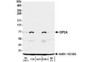 Western Blotting (WB) image for anti-KIAA1524 (KIAA1524) (N-Term) antibody (ABIN7452647)
