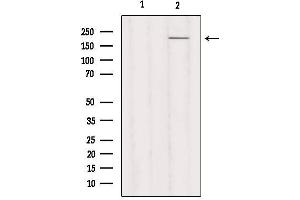 Western blot analysis of extracts from Hela, using MYH3 Antibody. (MYH3 antibody  (C-Term))
