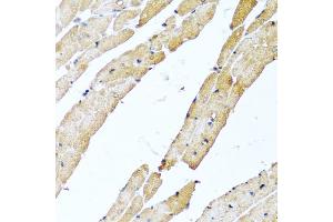 Immunohistochemistry of paraffin-embedded rat heart using CALCB antibody (ABIN5974487) at dilution of 1/100 (40x lens).
