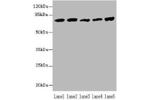 Western blot All lanes: Hspa1b antibody at 5 μg/mL Lane 1: A431 whole cell lysate Lane 2: A549 whole cell lysate Lane 3: Jurkat whole cell lysate Lane 4: MCF-7 whole cell lysate Lane 5: K562 whole cell lysate Secondary Goat polyclonal to rabbit IgG at 1/10000 dilution Predicted band size: 71 kDa Observed band size: 71 kDa (HSPA1B antibody  (AA 2-642))