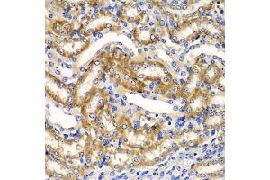 Immunohistochemistry of paraffin-embedded mouse kidney using ZFAND3 antibody (ABIN5975562) at dilution of 1/100 (40x lens). (ZFAND3 antibody)