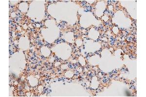 Immunohistochemistry (IHC) image for anti-Signal Transducer and Activator of Transcription 1, 91kDa (STAT1) (pSer727) antibody (ABIN6256410)