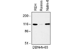 Western blotting analysis of drebrin expression in REH, Ramos, and Nalm-6 cell lysate using mouse monoclonal antibody DBN-N-03 .