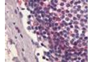 Anti-S1PR4 / EDG6 antibody IHC of human lymph node. (S1PR4 antibody  (C-Term))